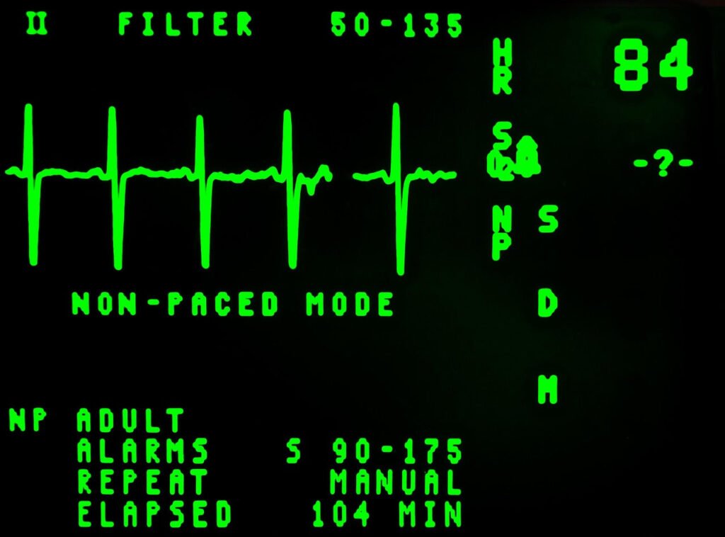 ECG trace and monitor readings displayed in green on a black screen.